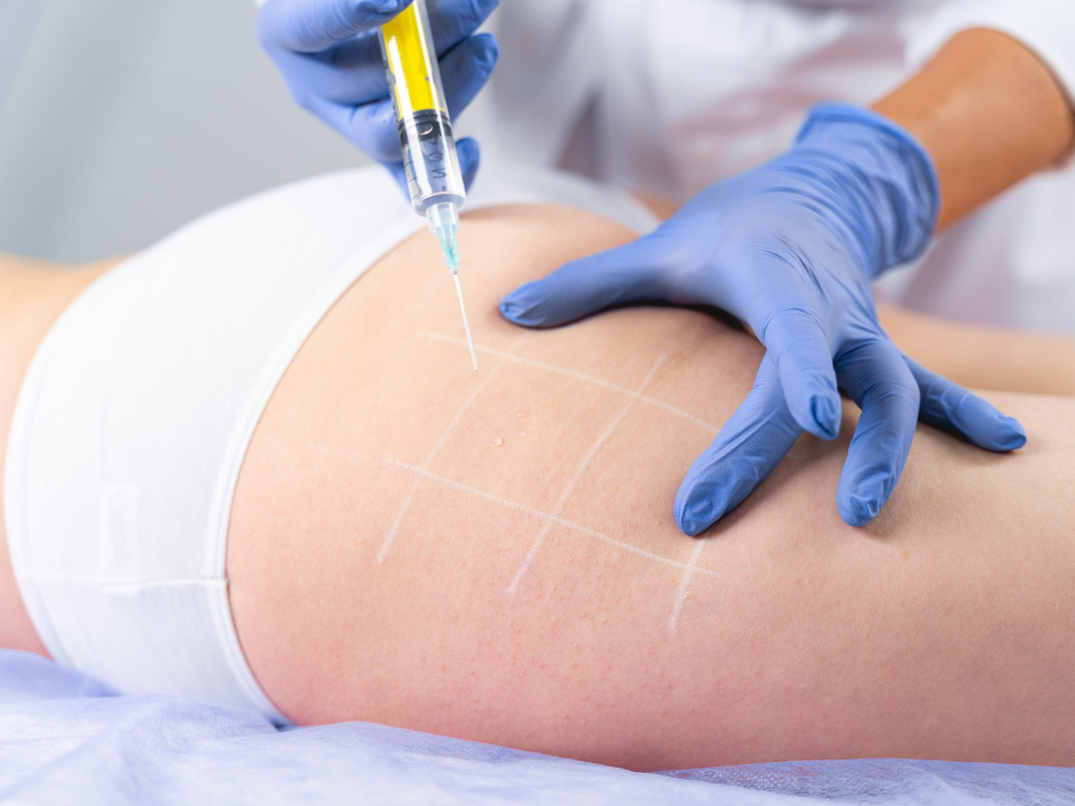 Fat Dissolving Injection 04