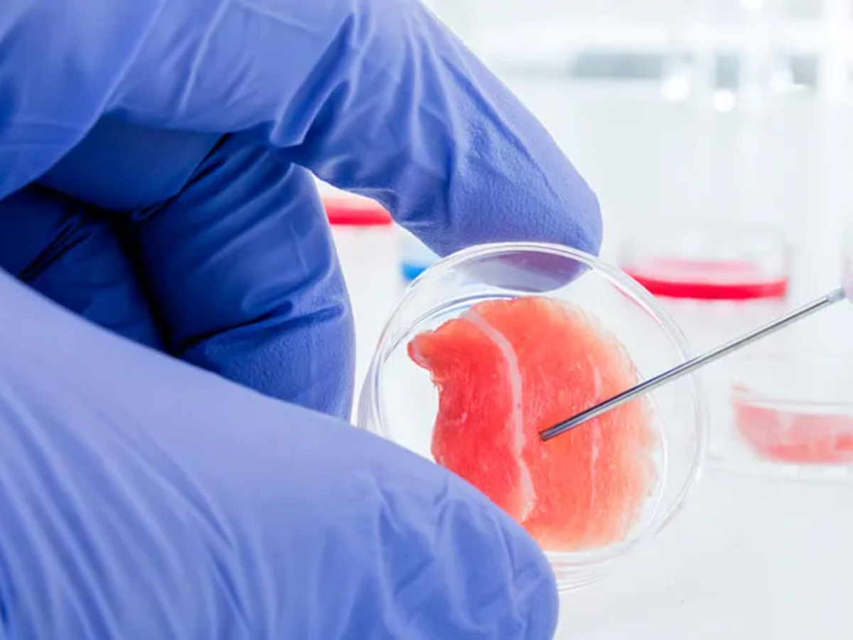 Stem cells 02