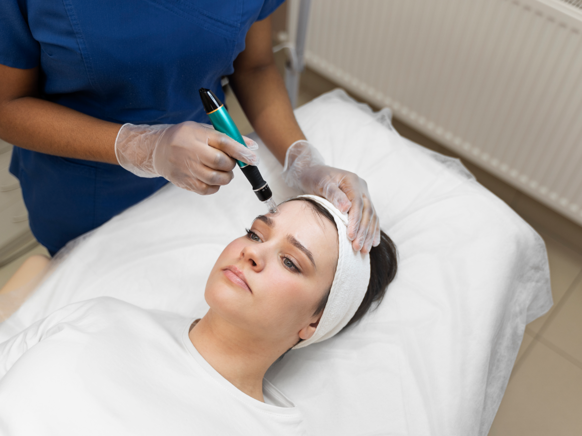 microneedling 03